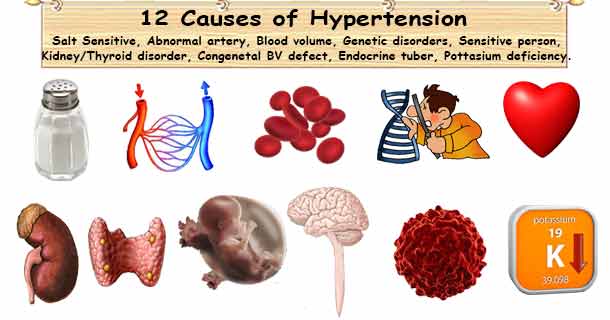 12 Hypertension Causes