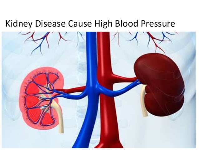 blood pressure causes