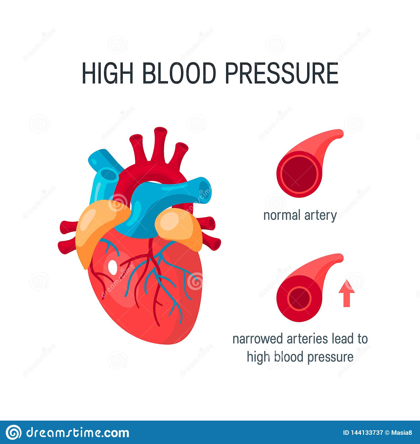 Blood Pressure Concept in Flat Style, Vector Stock Vector ...