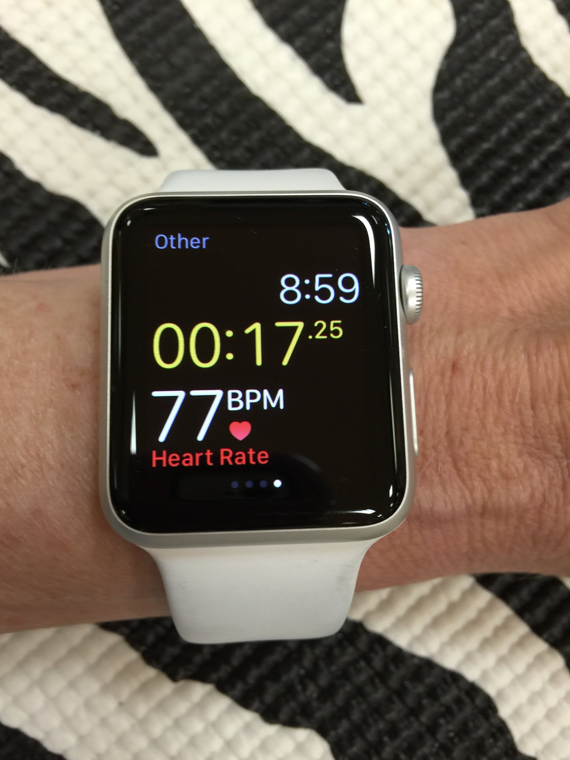 Can Apple Watch measure blood pressure? Here