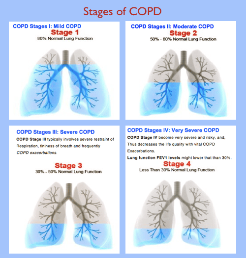 Can Cannabis Oil Reverse COPD? One Man