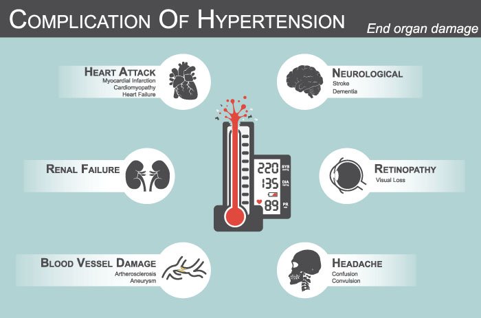 Can High Blood Pressure Cause Anxiety?