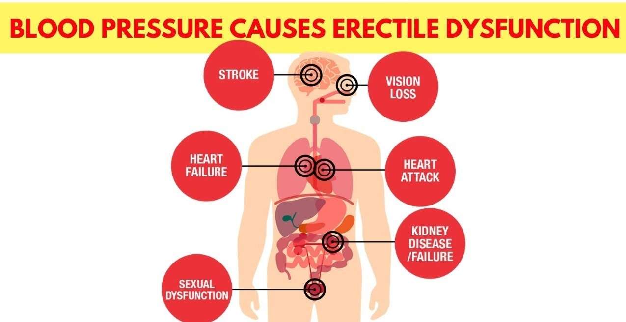 High Blood Pressure and Erectile Dysfunction: Causes and Treatment