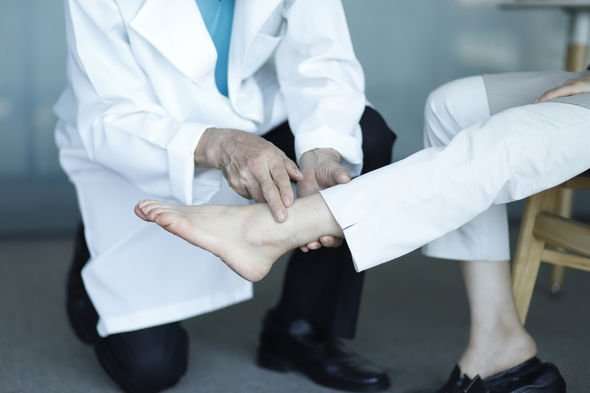 High blood pressure: Ankles that look swollen is a danger sign of ...