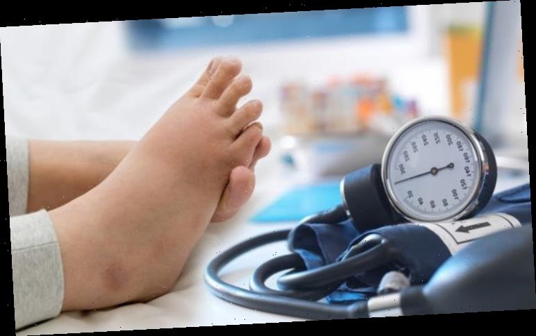 High blood pressure: Are your ankles more swollen than ...