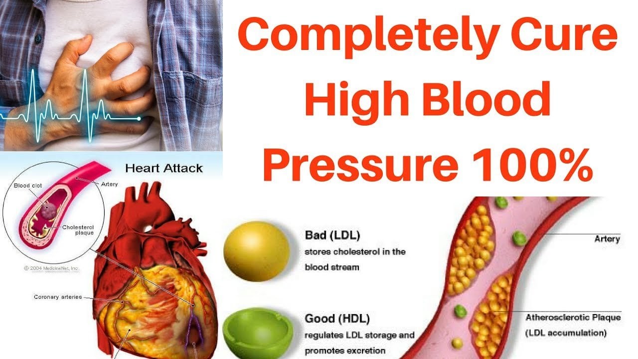 High BLOOD Pressure Cure (100%)