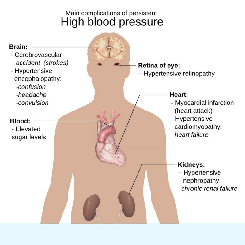 High Blood Pressure  Hypertension