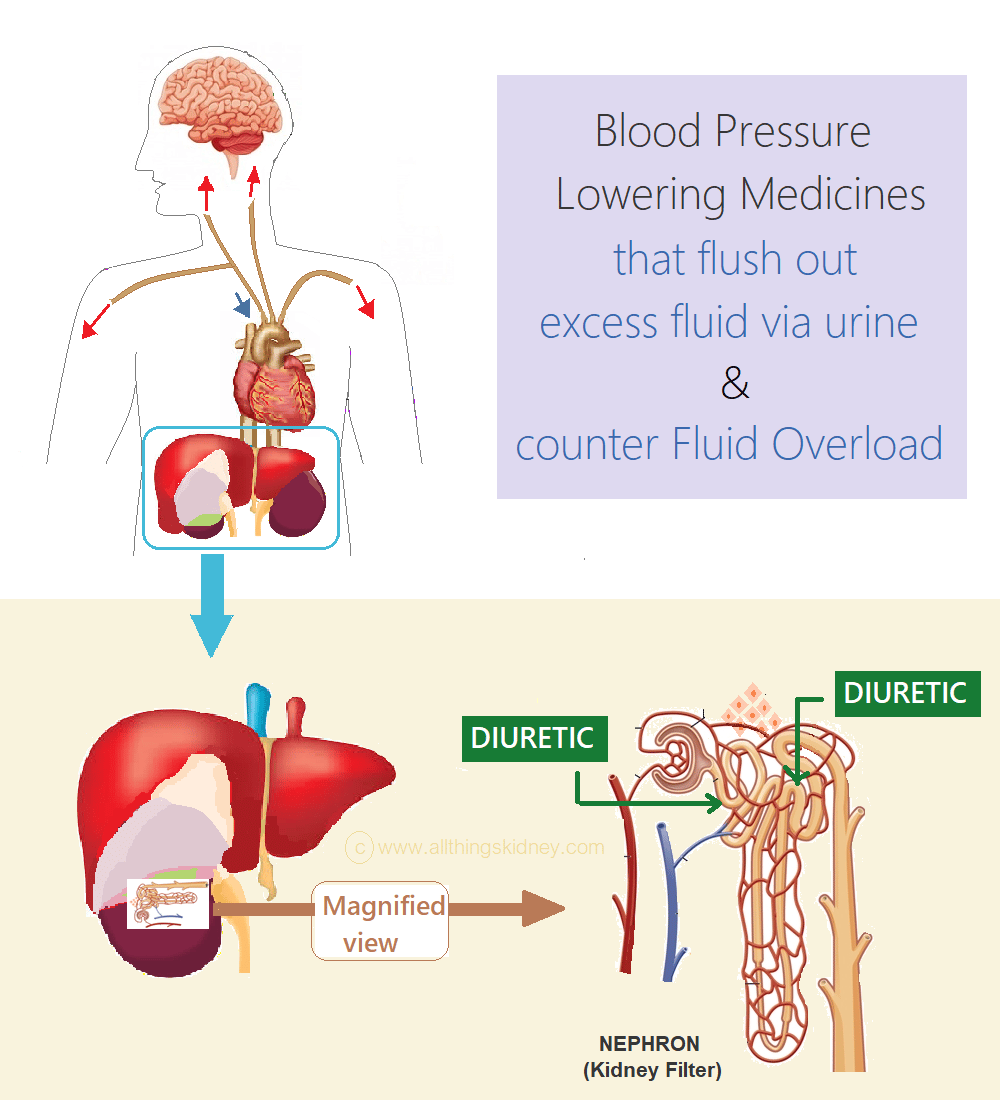 High Blood Pressure in CKD: Treatment All Things Kidney ~ Official