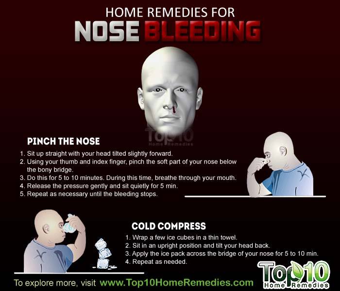 Home Remedies for Nosebleeds