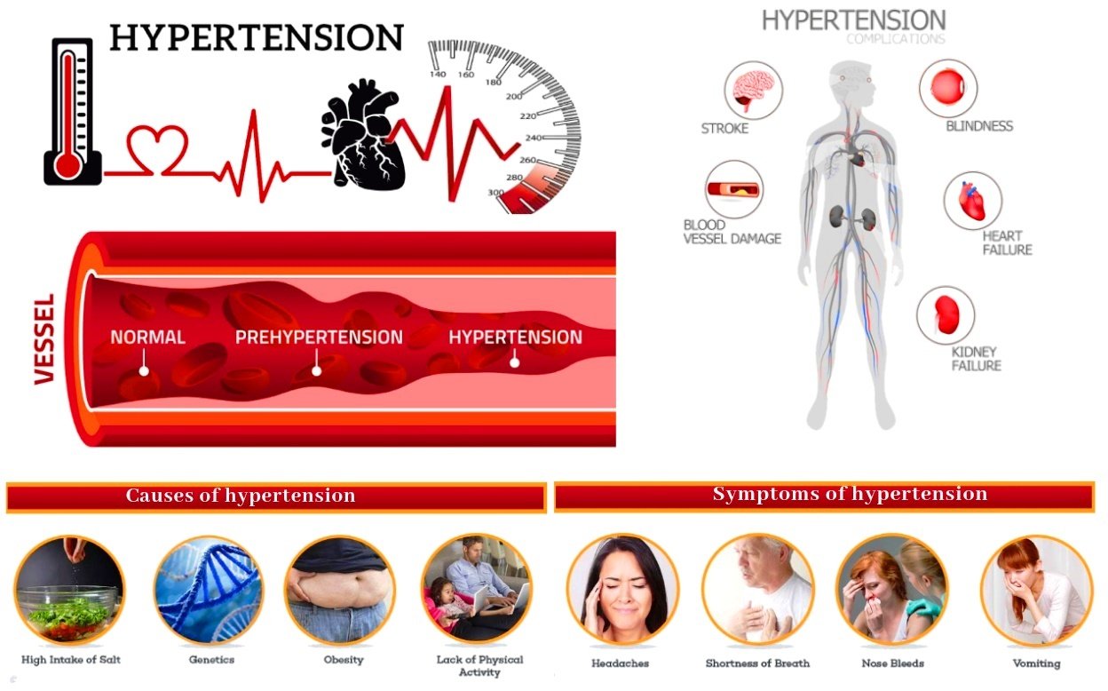 Hypertension Homeopathic Treatment symptoms,factors,causes ...