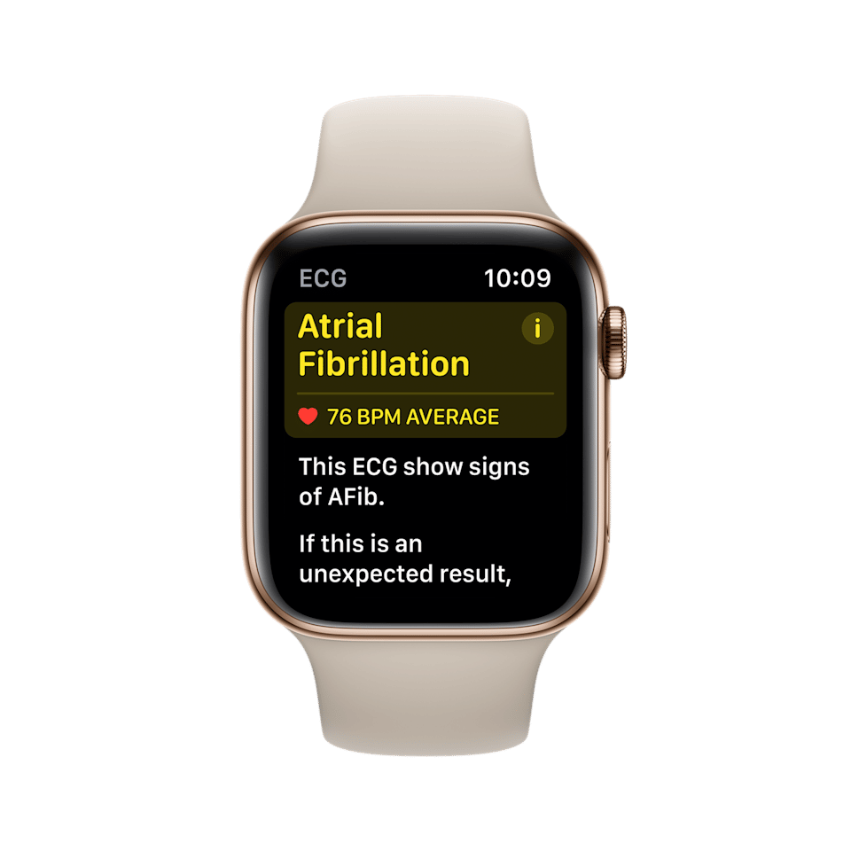 i tried the apple watchs new ecg feature before anyone else