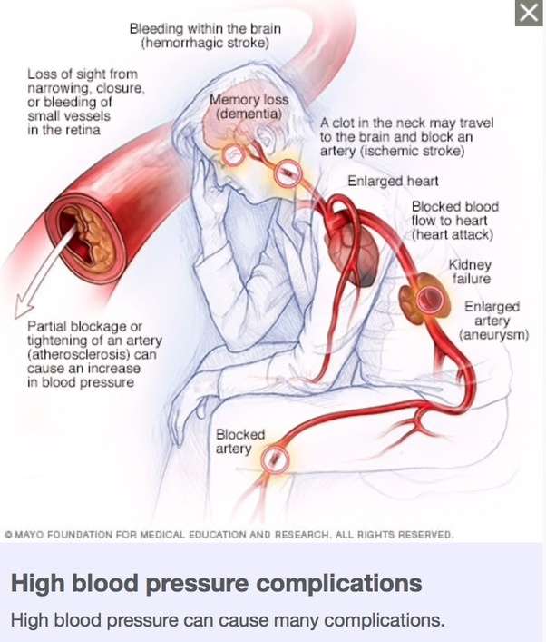 Is high blood pressure dangerous?