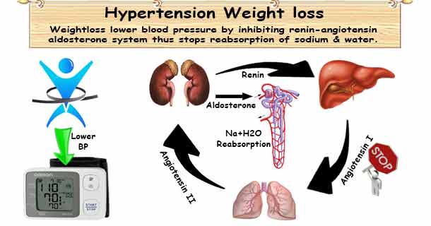 Obese Hypertensive Can Lower Blood Pressure by Losing Weight