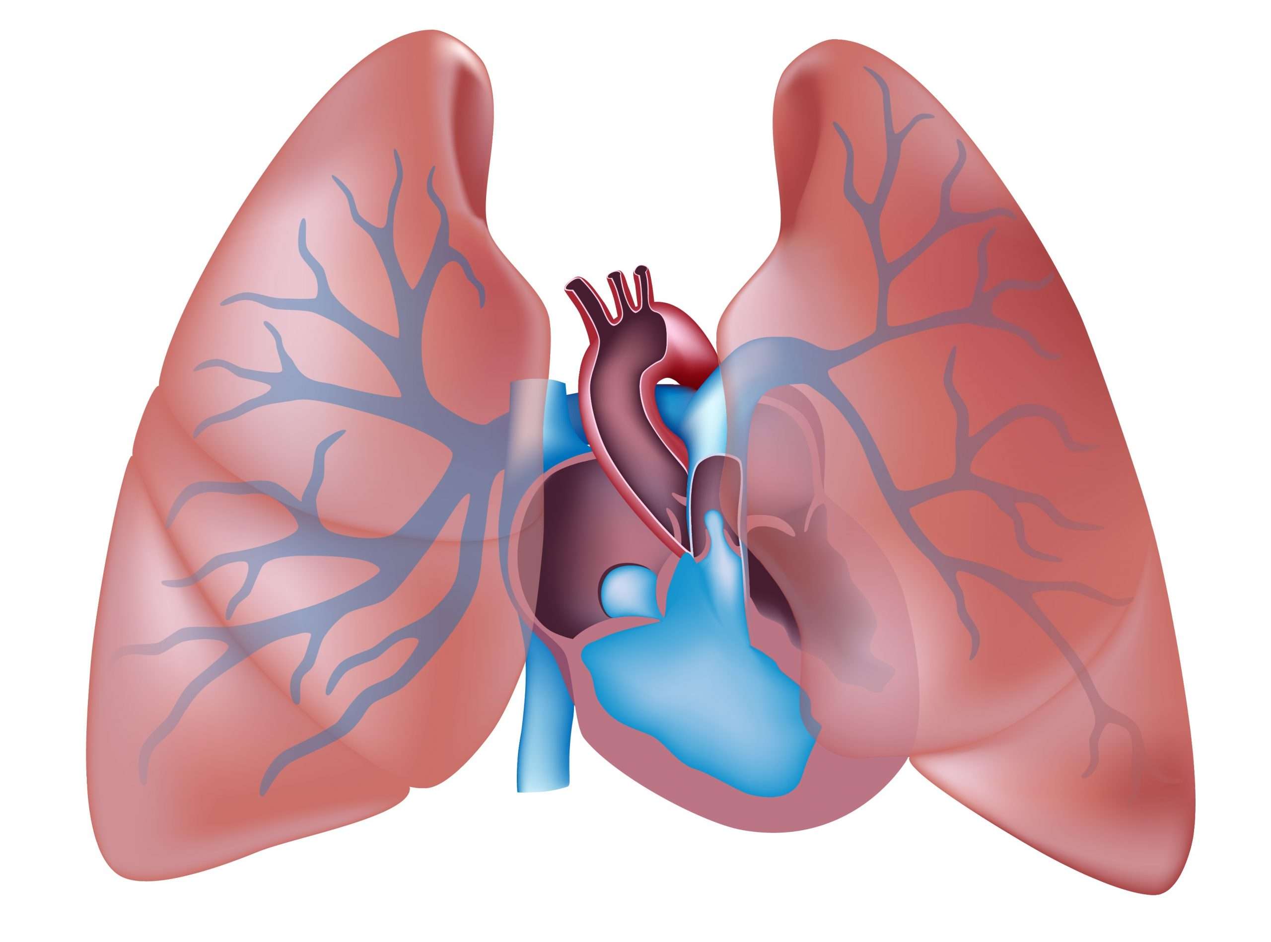 PDE5 Inhibitors Beneficial in WHO Group 1 Pulmonary Arterial ...