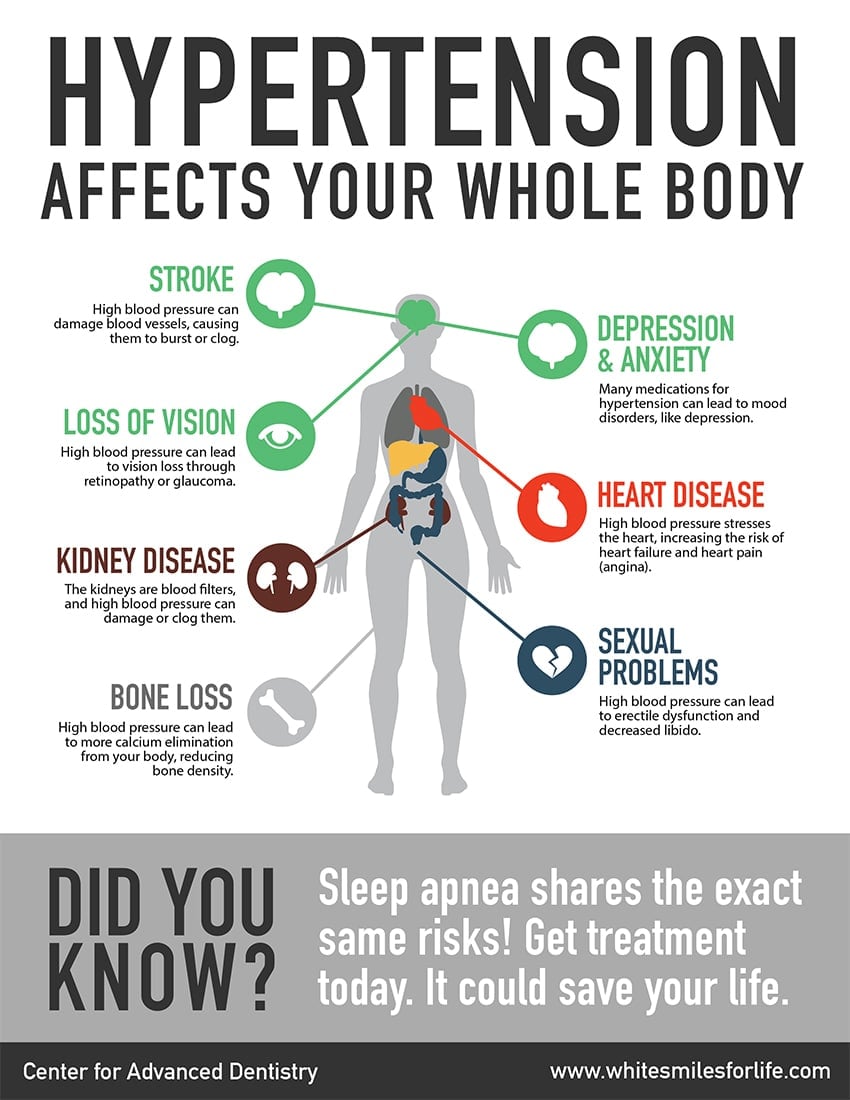 Share This Sleep Apnea / Hypertension Infographic and Save ...