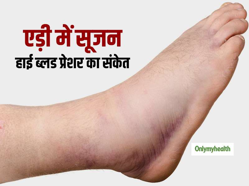 Swollen Ankles Can be Sign of High Blood Pressure Know The Risk Factors ...