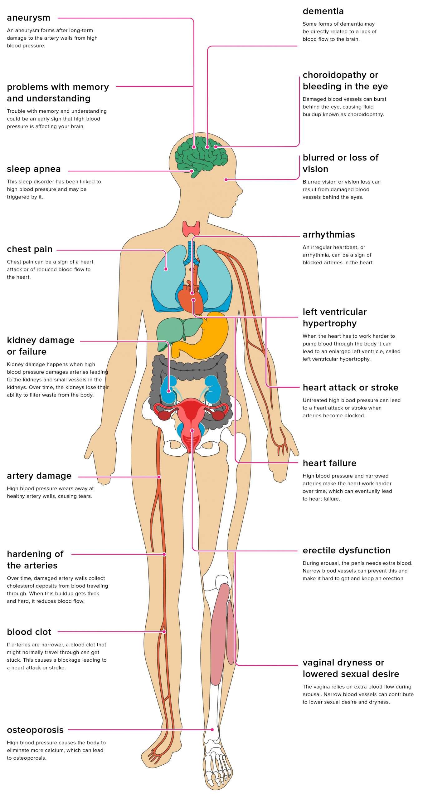 The Effects of Hypertension on the Body