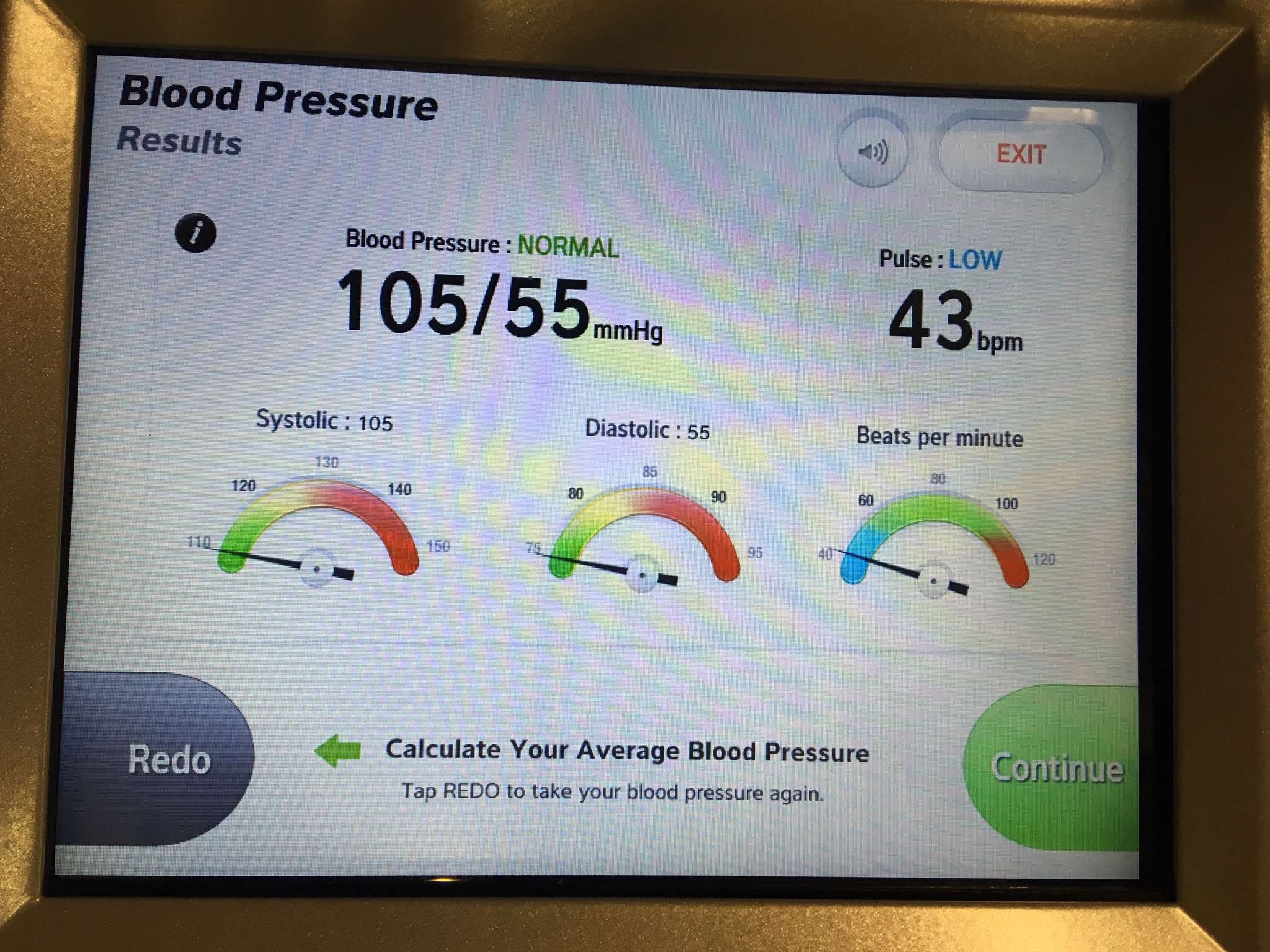 Too low blood pressure and heart rate? (muscle, treadmill, legs ...