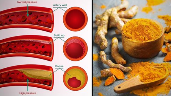 Turmeric For High Blood Pressure: How The Golden Spice Can Help