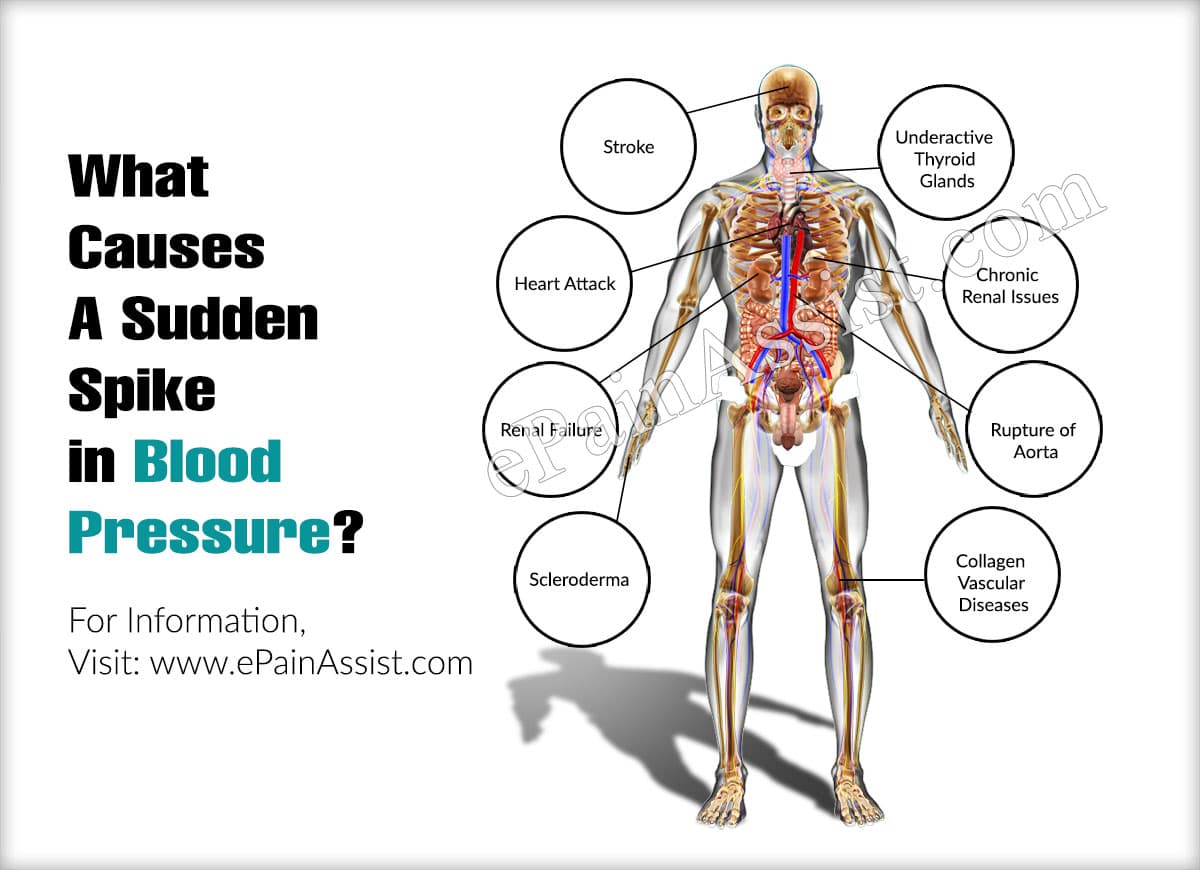 What Causes A Sudden Spike in Blood Pressure &  When Should ...