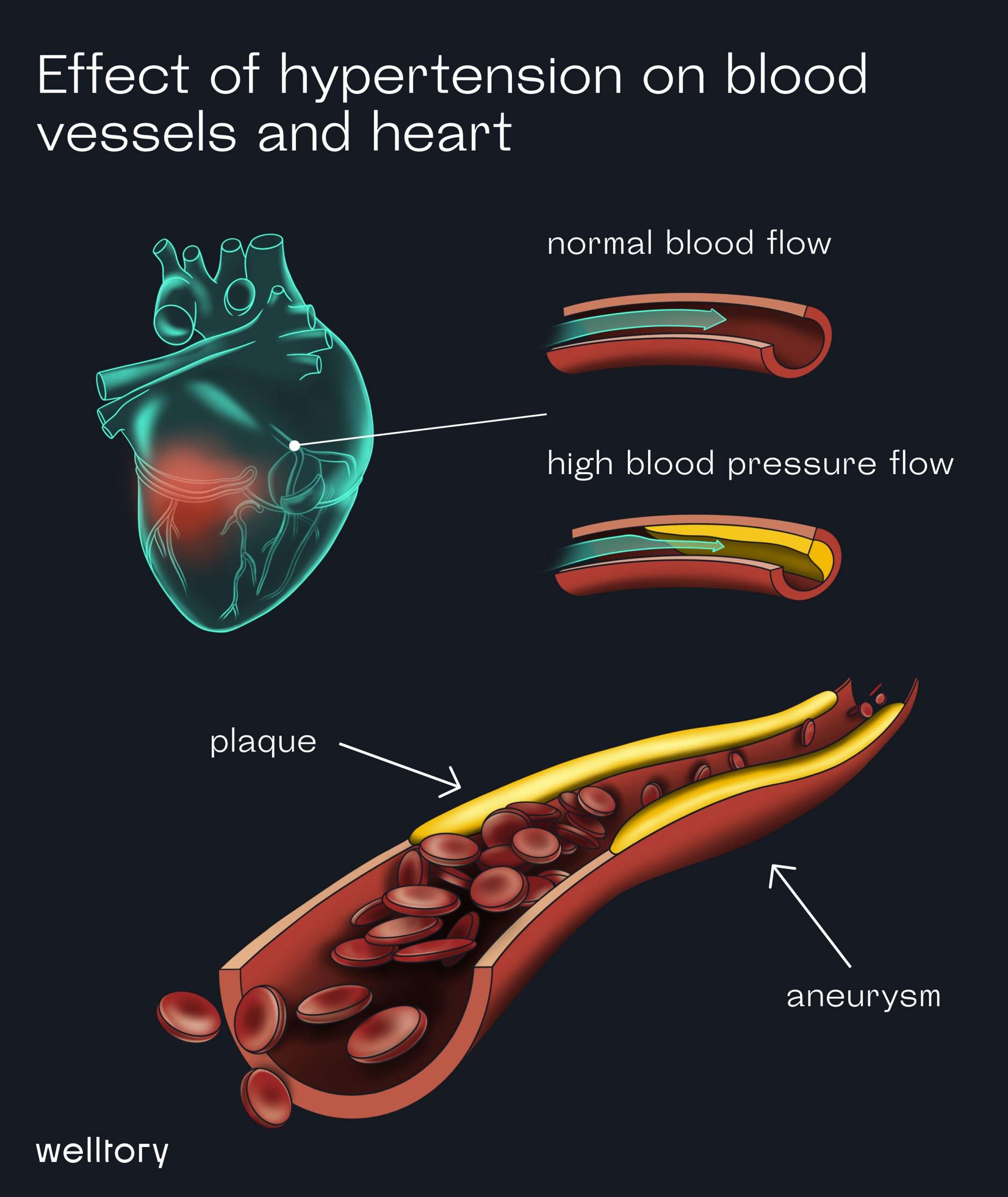 What is Blood pressure and how to analyze it?
