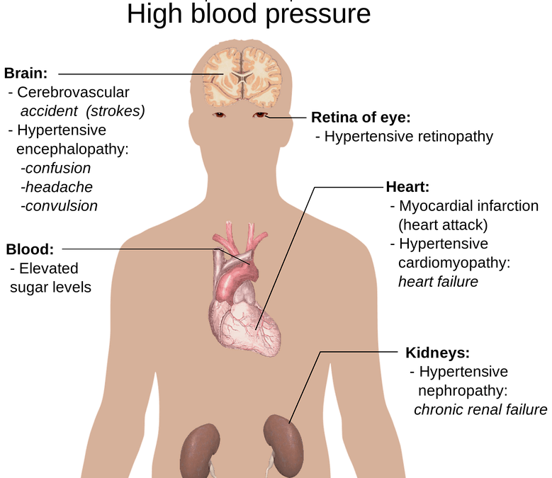 What is Hypertension?